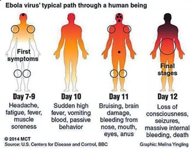 Preventing Ebola Outbreak in Haiti