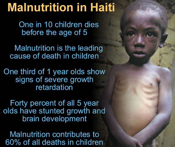 Malnutrition in Haiti