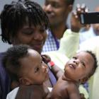 Medical first in Haiti, Conjoined twin separation
