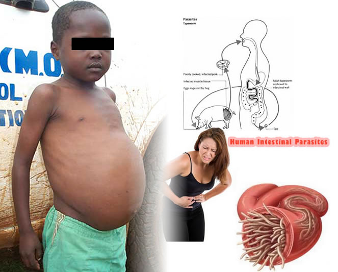 Some 25% of Haitian children suffer from intestinal parasites